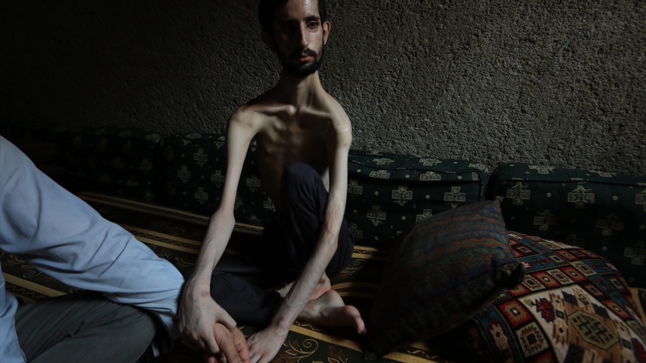 Hafif zihinsel engelli olarak dünyaya gelen Abdullah, Esed rejiminin 2015 yılındaki saldırısında kafası ve vücudunun farklı bölgelerine şarapnel parçalarının isabet etmesi sonucu hem bedensel hem de zihinsel engelli durumuna düştü.