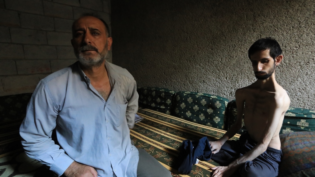 Abdullah`ın babası Sadettin Ebu el-Humsi ise günden güne eriyen oğluna gözü gibi bakmaya çalışıyor.