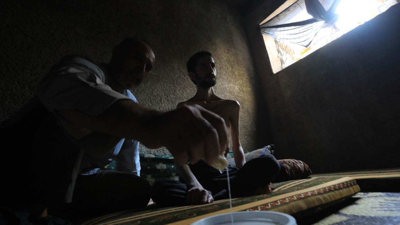 Felçli oğluna kol kanat geren 55 yaşındaki baba, bilinmeyen hastalığından dolayı ağırlığı 35 kilograma kadar düşen Abdullah`ın tedavisi için yardım bekliyor.