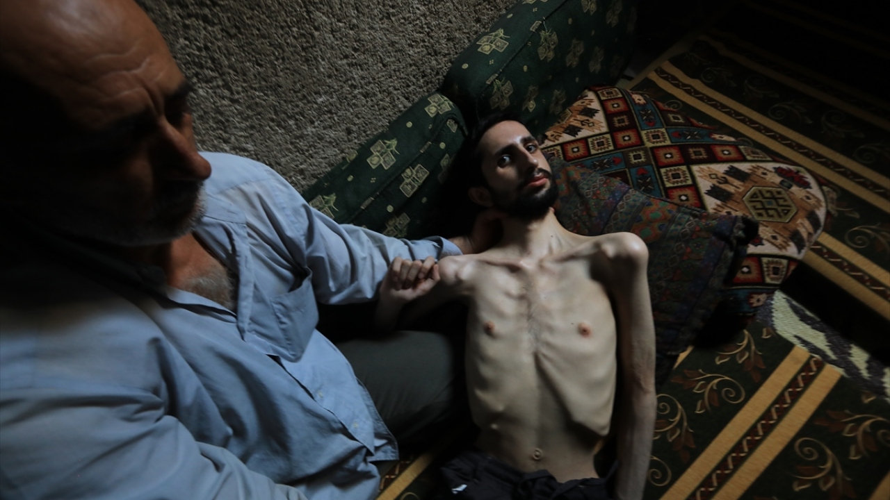 Ebu el-Humsi, 3 Aralık Dünya Engelliler Günü dolayısıyla yaşadıkları zorlukları ve oğlunun çektiği acıları anlattı.