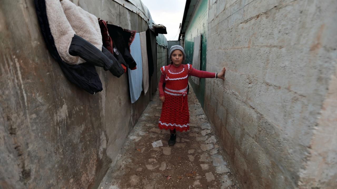 Esed rejiminin hava saldırısında 3 yıl önce sol bacağını kaybeden 6 yaşındaki Esra`nın hikayesi yürekleri burkuyor.