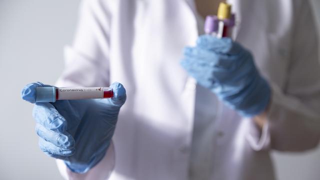 Karşıyakada koronavirüs testi pozitif çıkan kişi sayısı 14 oldu