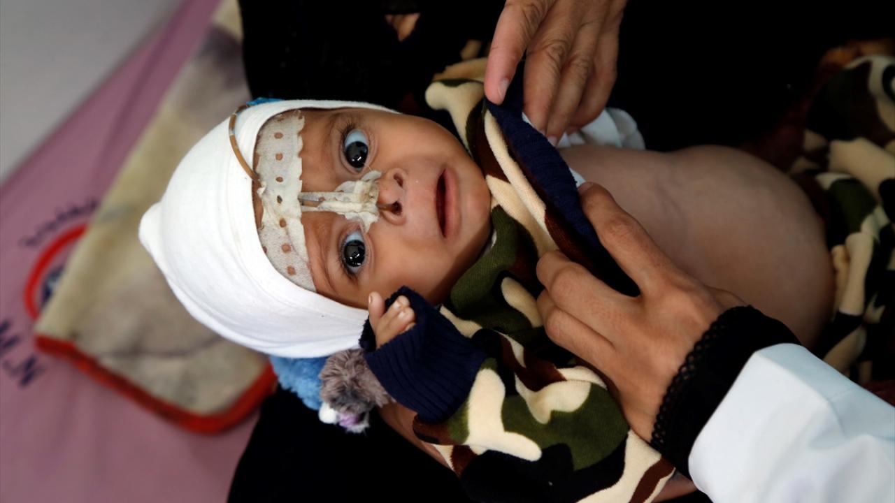 Ülkede savaş koşulları, siyasi sorunlar ekonomik durum nedeniyle ağırlaşan insani kriz, Kovid-19 salgını sonrasında daha da derinleşti.  