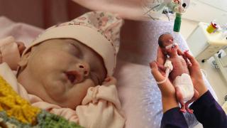 Nisa bebek mucizesi: 520 gram doğdu, hayata tutundu