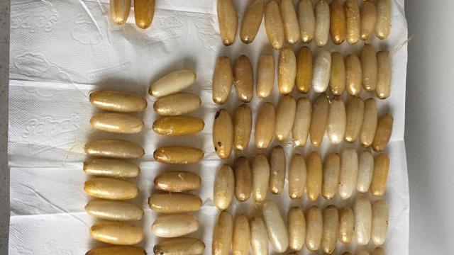 İstanbul Havalimanında yakalandı, midesinden uyuşturucu çıktı