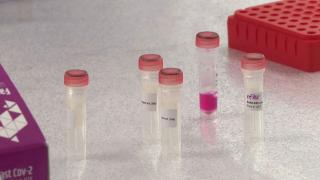 Yerli ve milli imkanlarla üretildi: 30 dakikada sonuç veriyor