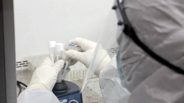 Filyasyon ekibi temaslıları pide kutusundan yakaladı