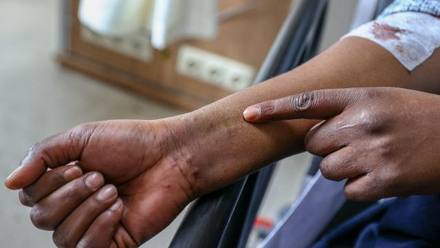 Gaziantepte FETÖ operasyonu: 6 gözaltı