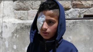 Filistinli çocuk hem gözünü hem de hayallerini kaybetti