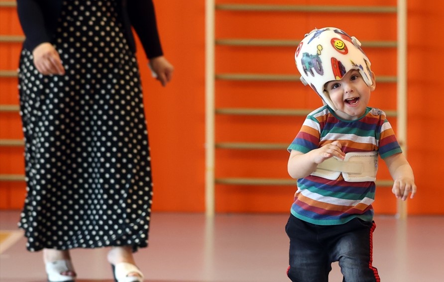 Londra`daki 3 büyük ameliyatla başları ayrılmıştı