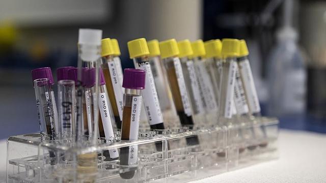 Hepatit B görülme sıklığı 100 binde 1in altına düştü