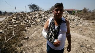 Alevlerin sardığı evden ailesini kurtaran adam, başka bir yangında yaralandı