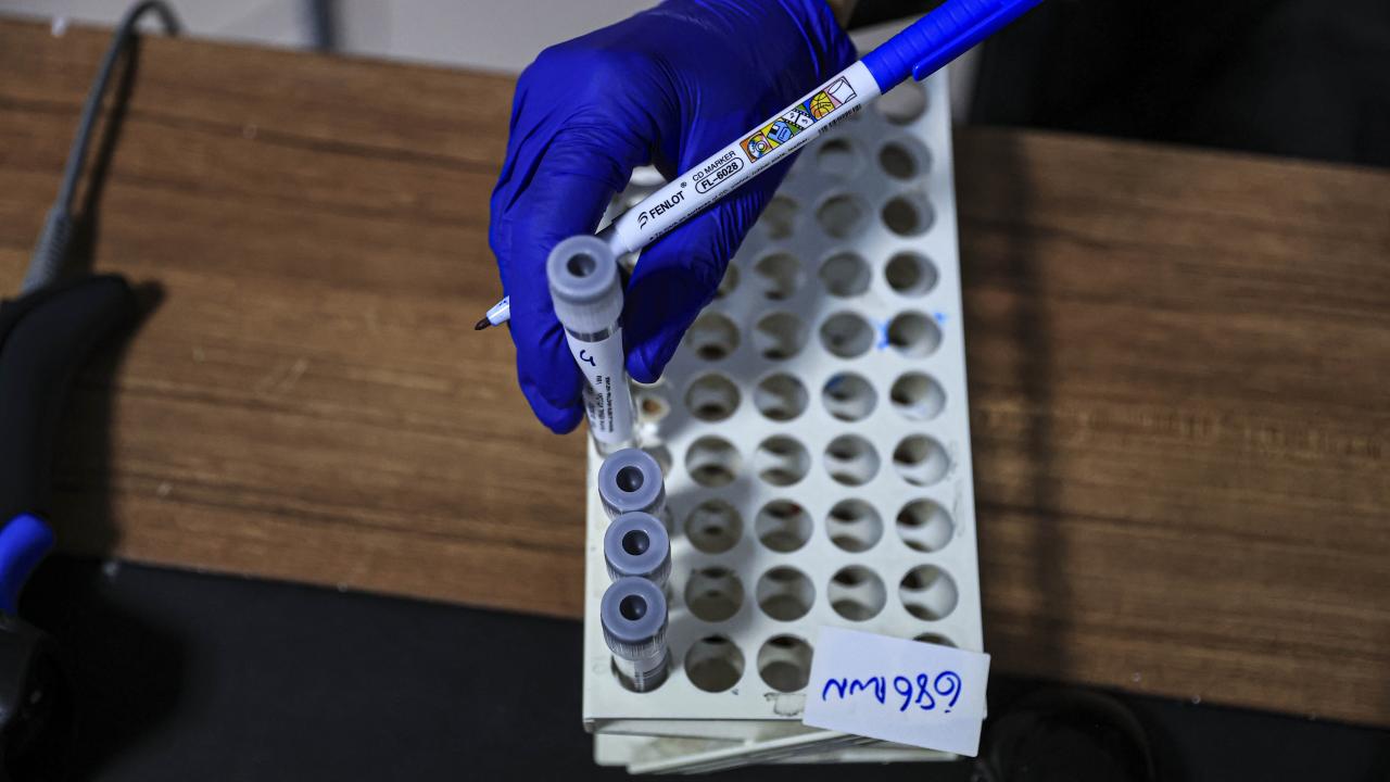 <b>Zorunlu PCR testleri, devlet hastanelerinde ücretsiz yapılacak</b>