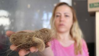 Kadın hasta hemşirenin saçını yoldu