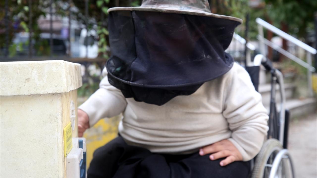 "Engeli olan insanlar karamsarlığa düşmesin"