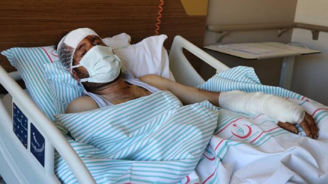 Bozayı saldırısına uğrayan kişi yaşadıklarını anlattı
