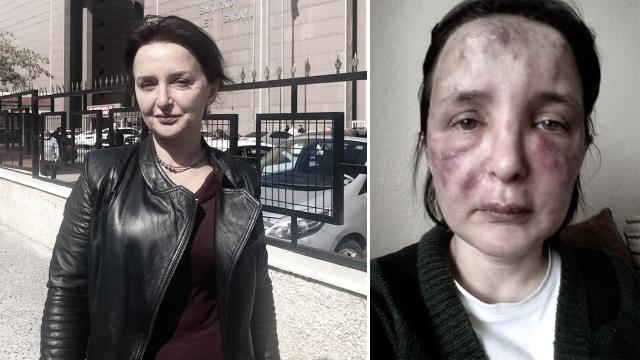 Yüzüne dolgu yaptığı kadının hayatını karartan sahte doktora 3 yıl 4 ay hapis