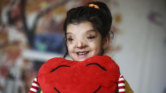 Minik Ayşenurun normalden daha ayrık olan gözleri ameliyatla yaklaştırıldı