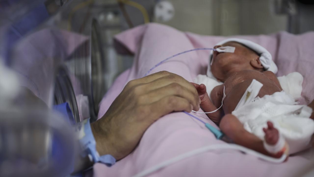 Anne 24 haftalık gebeyken işlem yapıldı