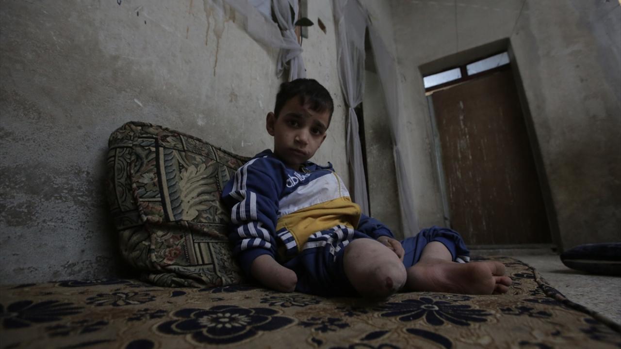 "Oğlumun protezlerine kavuşmasını istiyorum"