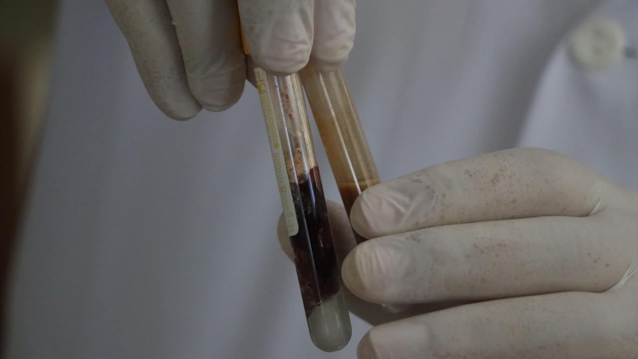 20 dolarlık ilaç yerli imkanlarla 5 dolara üretildi