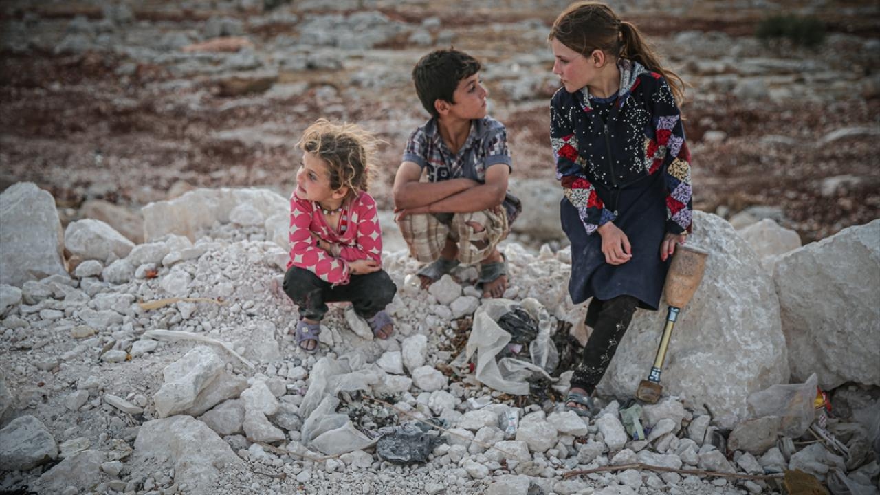 "`Senin bacağın kesik` diyorlar"