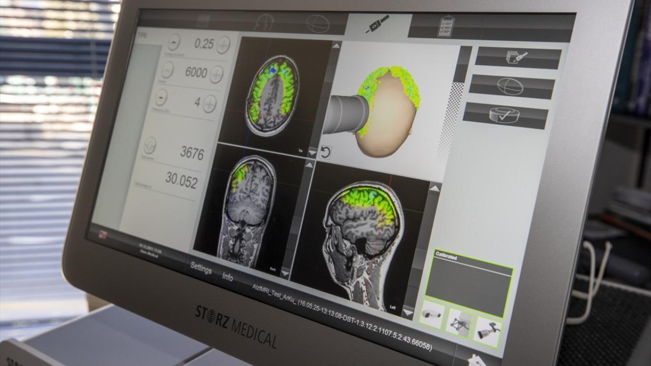 "Kaybedilen bazı fonksiyonlarının geri kazanımını sağlıyor"