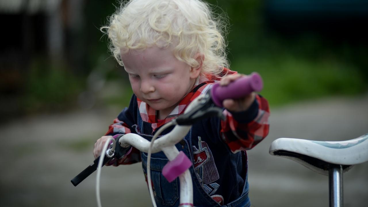 17 bin de bir görülüyor