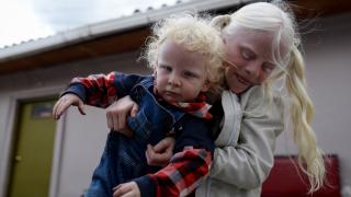 Kolombiya'da albino nüfusu ayrımcılığa karşı mücadele ediyor