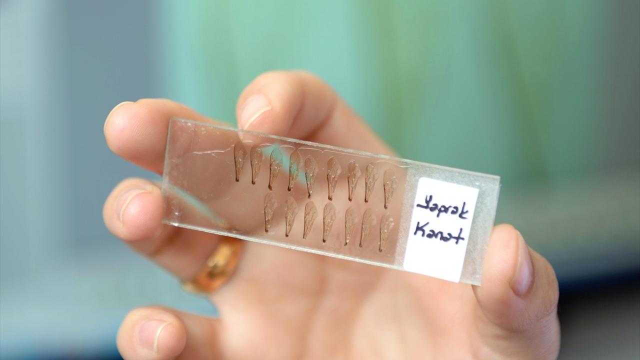 Sağlıklı sonuç için genç işçi arılar inceleniyor