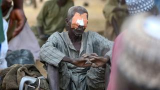 Afrikalı katarakt hastaları DİTİB ve TDV iş birliğiyle ameliyat ediliyor