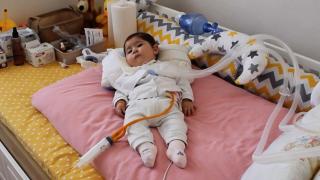 10 aylık Emine Asya'nın tek umudu gen tedavisi