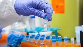 30 dakikada sonuç veren yerli COVID-19 tanı kiti pazartesi piyasada