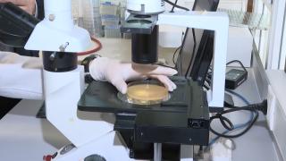 Kişinin kendi derisinden yapay deri üretmeyi başardılar