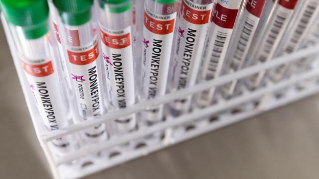 DSÖ: Avrupada son 2 haftada maymun çiçeği vakaları üçe katlandı
