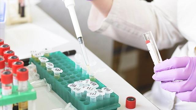 Meksikada 5 kişide daha maymun çiçeği virüsü tespit edildi