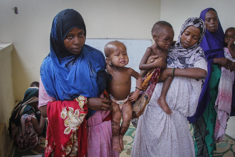 Anal jinsiy aloqada bolgan seksual opa-singillarning porno videolarini tomosha qiling