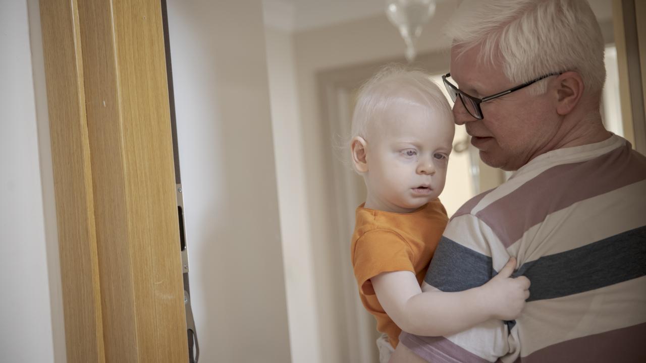 Albinizmli aile çocuklarıyla albinizmlilere örnek oluyor