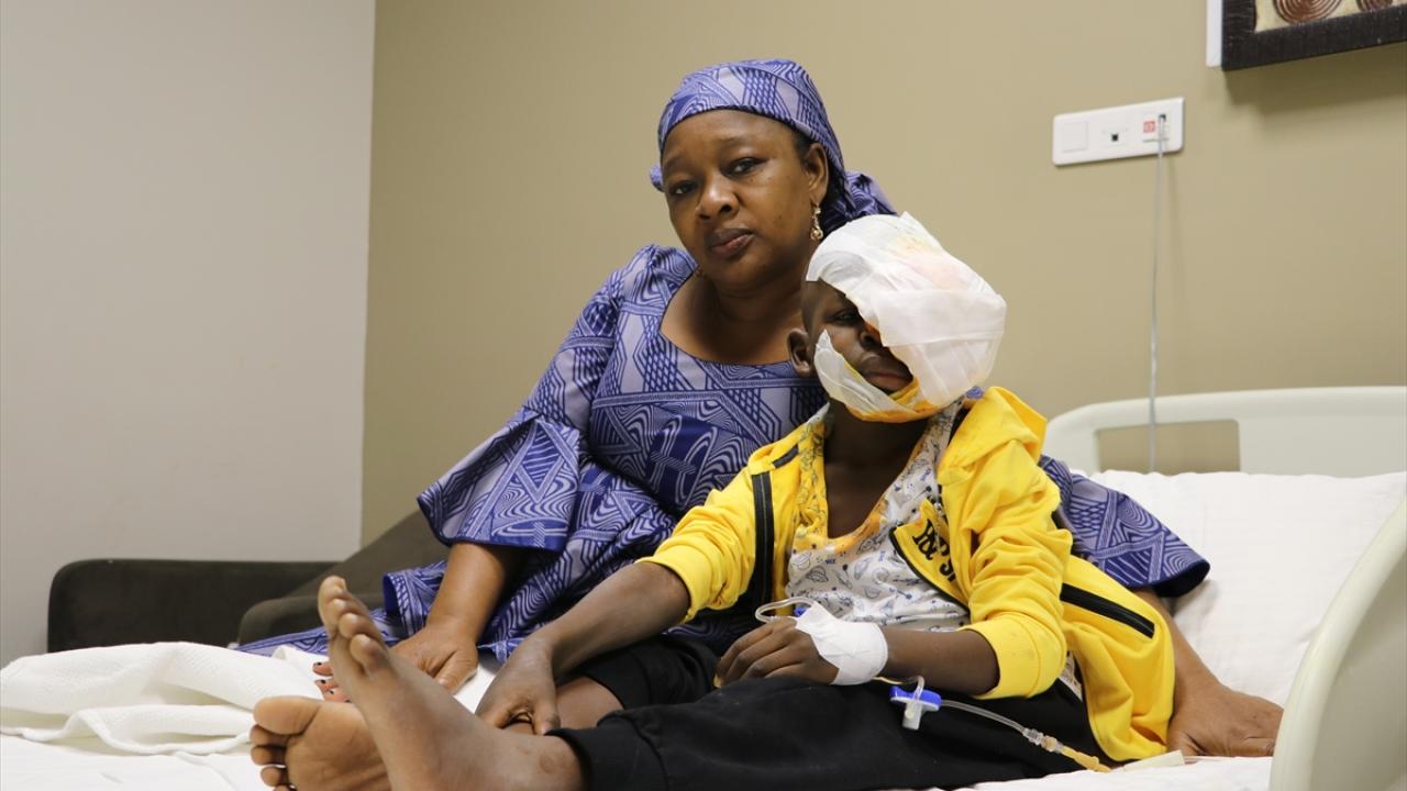 "Nadir rastlanan bir hastalık"