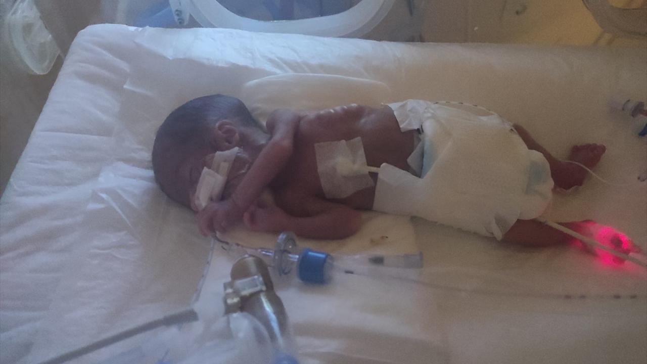 "Bu bebekler, prematüre değil, immatür"