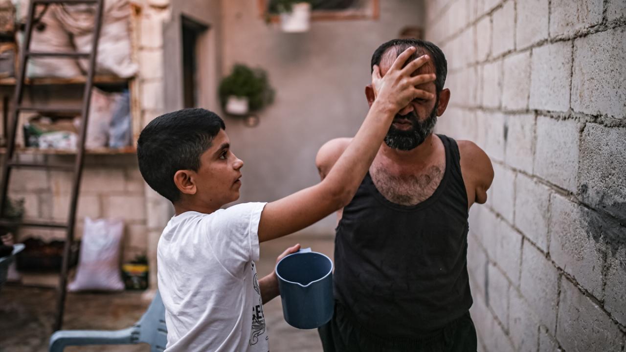 "İki kolumu kaybettiğim aklımdan hiç çıkmıyordu"