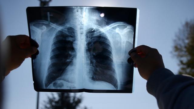 İspanya 114 yıl sonra ülkede ilk kez gözlemlenecek tam güneş tutulmasına hazırlanıyor haber görseli