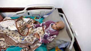 Yemen'deki iç savaş kanser hastalarını da vurdu