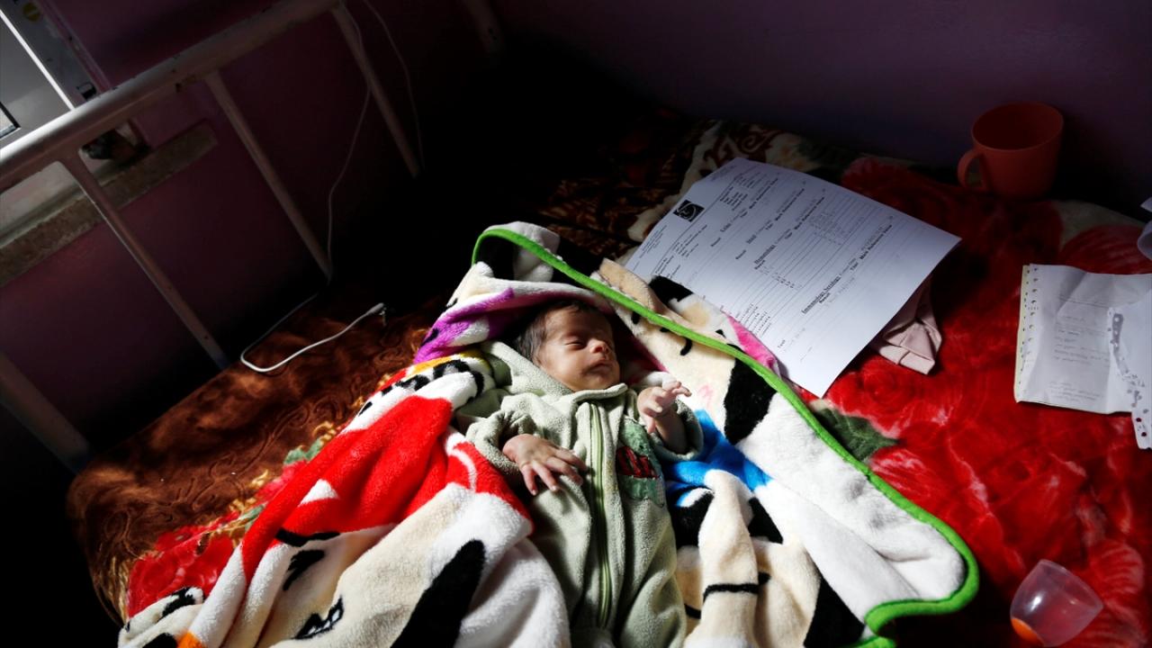 Yemen'de yarım milyon çocuğun hayatı yetersiz beslenme nedeniyle tehlikede