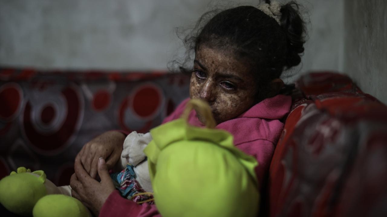 "Onlarla sadece işaretle anlaşabiliyorum"