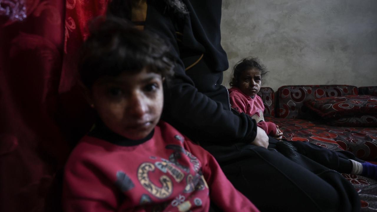 "Evlatlarım diğer çocuklar gibi günlük hayatlarını yaşayamıyorlar"