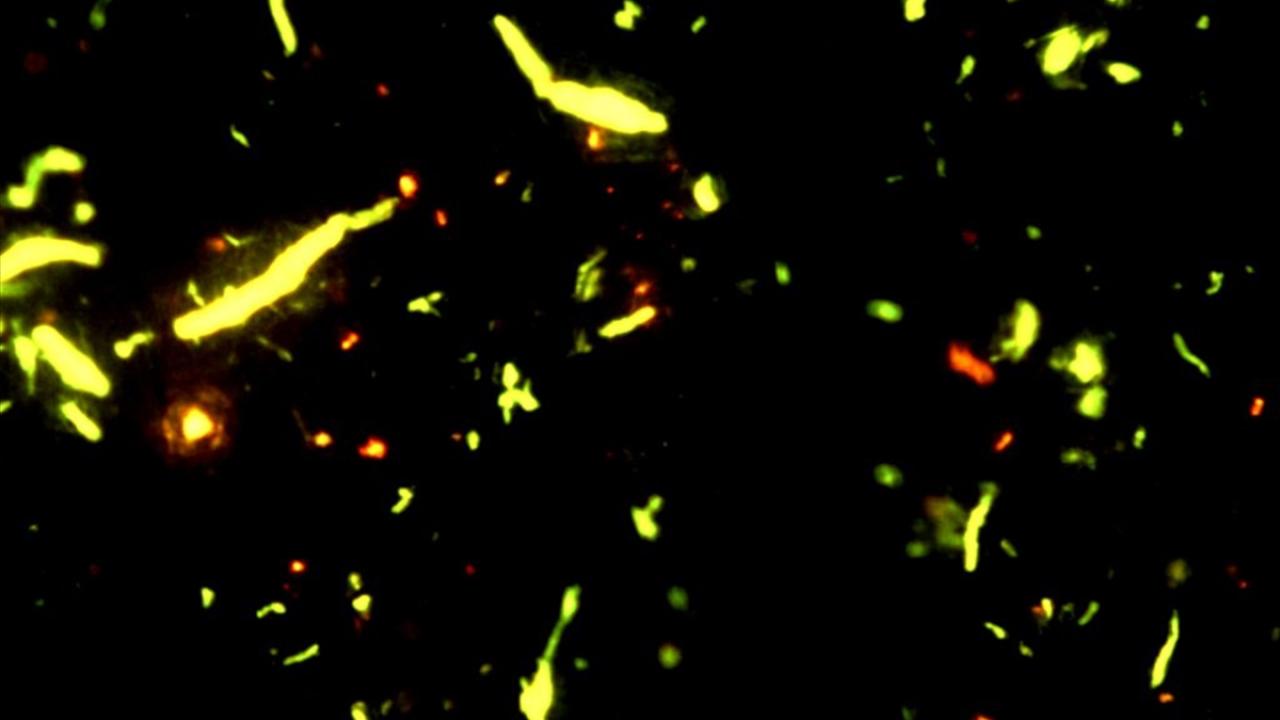 "Farklı renklerde mikroplastik parçacıklarına rastladık"