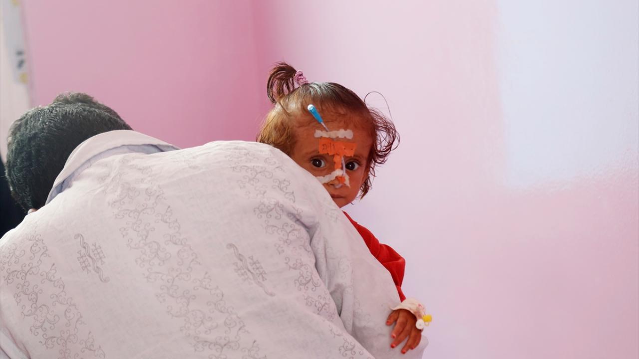 Yemen`deki iç savaş ve insani kriz