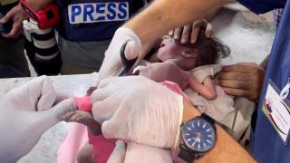 Gazze'deki yaralılar hastanelerde yaşam savaşı veriyor