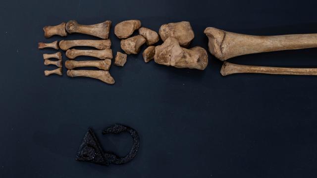 Arkeologlar Polonya mezarl���nda 'vampirleri' ortaya ��kard�